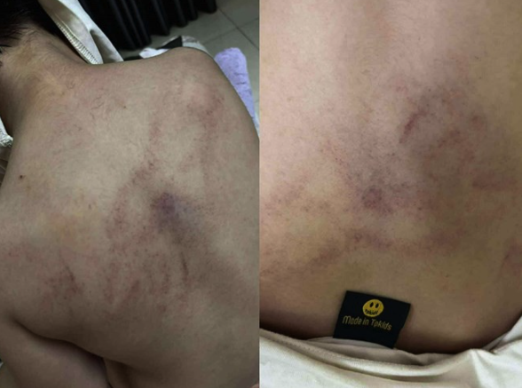 Tạm đình chỉ công tác 2 giáo viên nghi bạo hành trẻ- Ảnh 1.