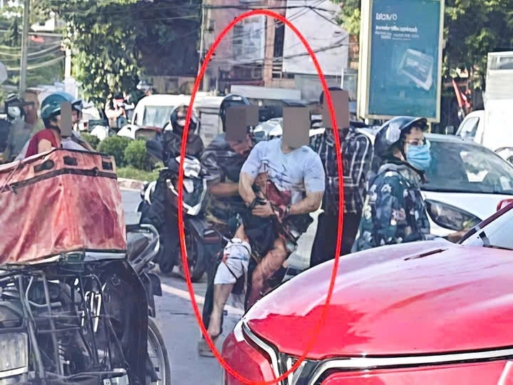 Tiktoker bị chém gần đứt lìa bàn tay giữa phố Thái Nguyên: Bác sĩ thông tin về ca mổ kéo dài đến 1h sáng- Ảnh 3.