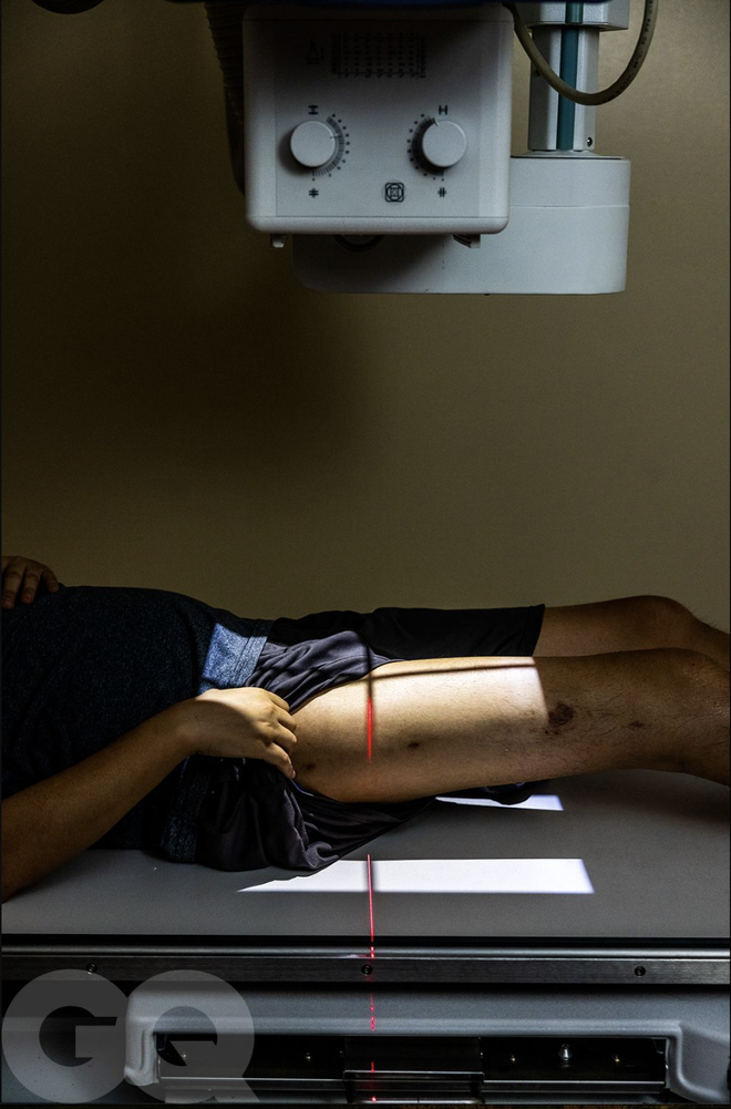 Đàn ông Mỹ ám ảnh chiều cao, đổ xô đi phẫu thuật kéo dài chân- Ảnh 10.