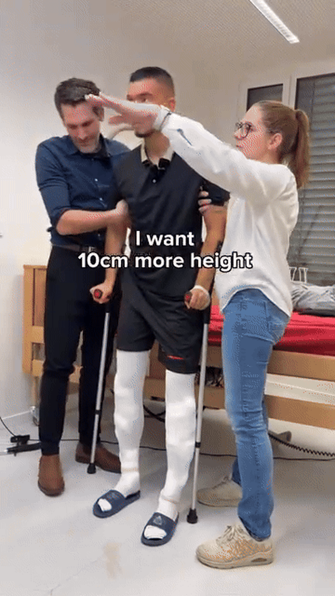 Đàn ông Mỹ ám ảnh chiều cao, đổ xô đi phẫu thuật kéo dài chân- Ảnh 6.