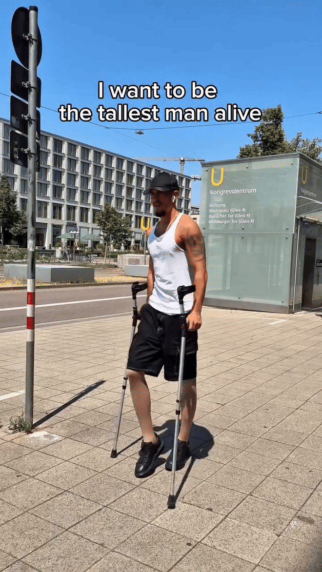 Đàn ông Mỹ ám ảnh chiều cao, đổ xô đi phẫu thuật kéo dài chân- Ảnh 7.