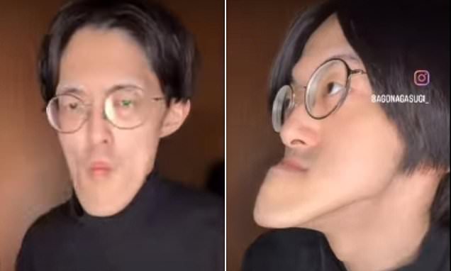 Người đàn ông có "chiếc cằm dài nhất thế giới", vẫn tiếp tục dài ra- Ảnh 1.