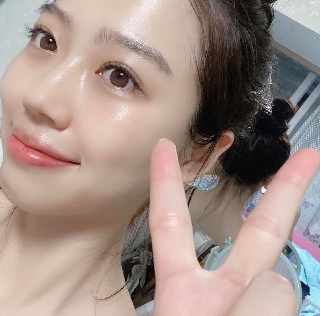 Viên uống chống già giúp xóa nếp nhăn nhưng gây rụng tóc khi dùng sai liều lượng- Ảnh 2. Viên uống chống già giúp xóa nếp nhăn nhưng gây rụng tóc khi dùng sai liều lượng- Ảnh 2.