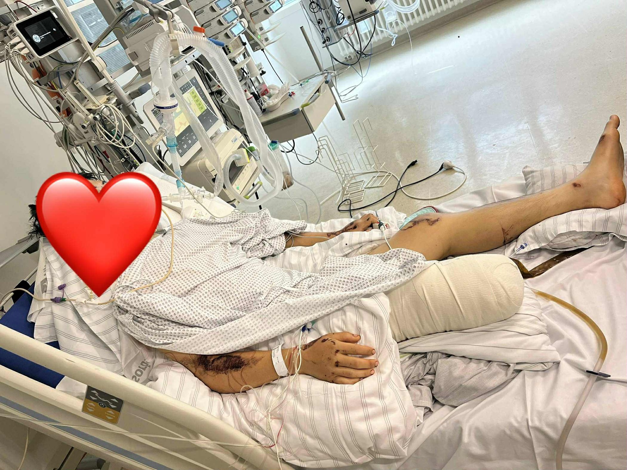 2 du học sinh Việt tử vong, 1 nam sinh nguy kịch sau tai nạn nghiêm trọng ở Đức - người yêu khẩn cầu trợ giúp- Ảnh 2. 2 du học sinh Việt tử vong, 1 nam sinh nguy kịch sau tai nạn nghiêm trọng ở Đức - người yêu khẩn cầu trợ giúp- Ảnh 2.