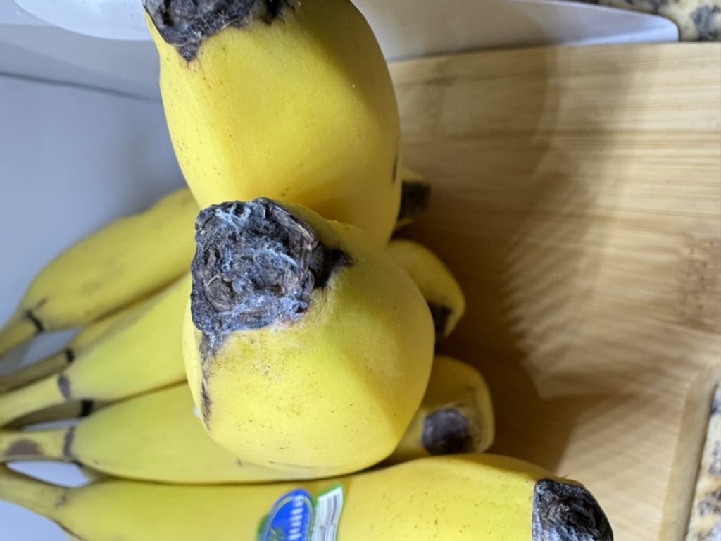 Phát hiện chất độc gấp hàng chục lần thạch tín trong dạ dày người phụ nữ 5 năm không chịu thay đũa mới- Ảnh 3.