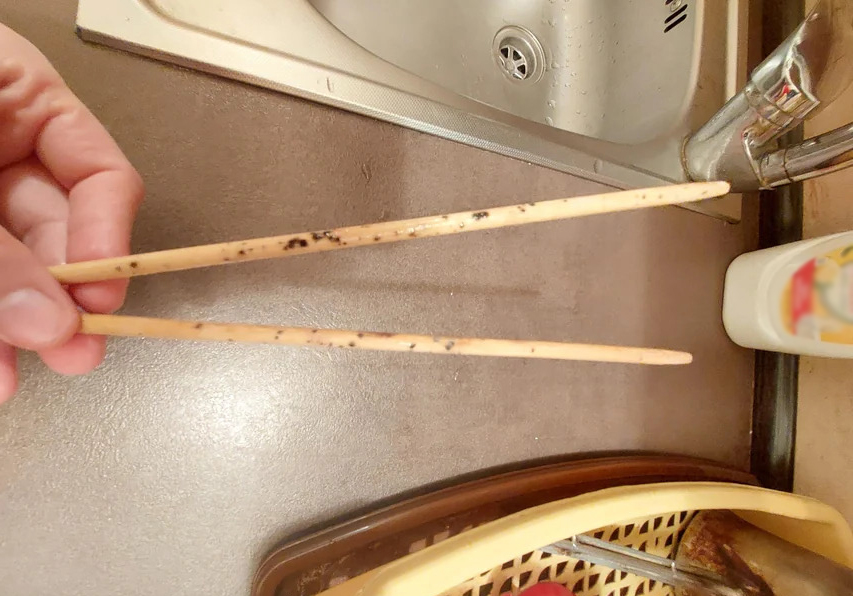 Phát hiện chất độc gấp hàng chục lần thạch tín trong dạ dày người phụ nữ 5 năm không chịu thay đũa mới- Ảnh 2.