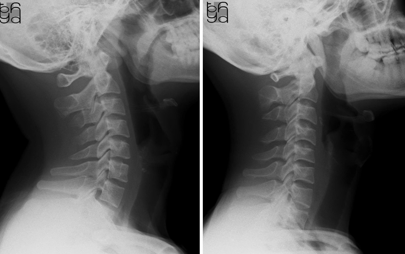 Người trẻ 20 tuổi mà xương khớp như 'người già': Bác sĩ nói đa số đều có 4 đặc điểm, sửa ngay còn kịp