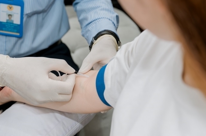 Mắc bệnh gout ở tuổi đôi mươi- Ảnh 1.