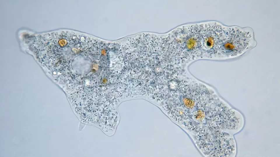 Bé trai 6 tuổi tử vong vì "amip ăn não" sau khi chơi dưới nước- Ảnh 2.