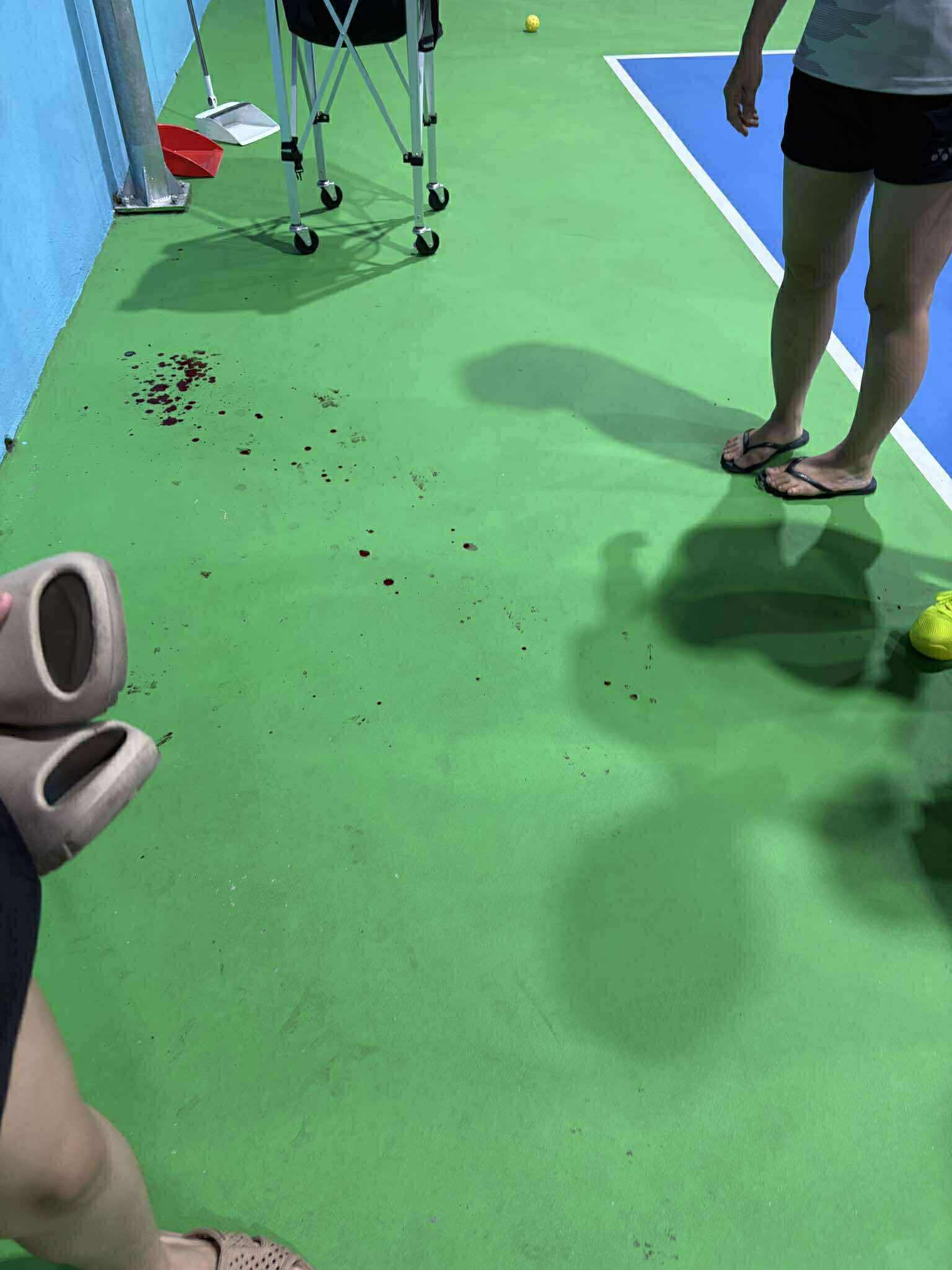 Xôn xao vụ cô gái bị ném vợt vào mặt trên sân pickleball, phải nhập viện cấp cứu- Ảnh 3.