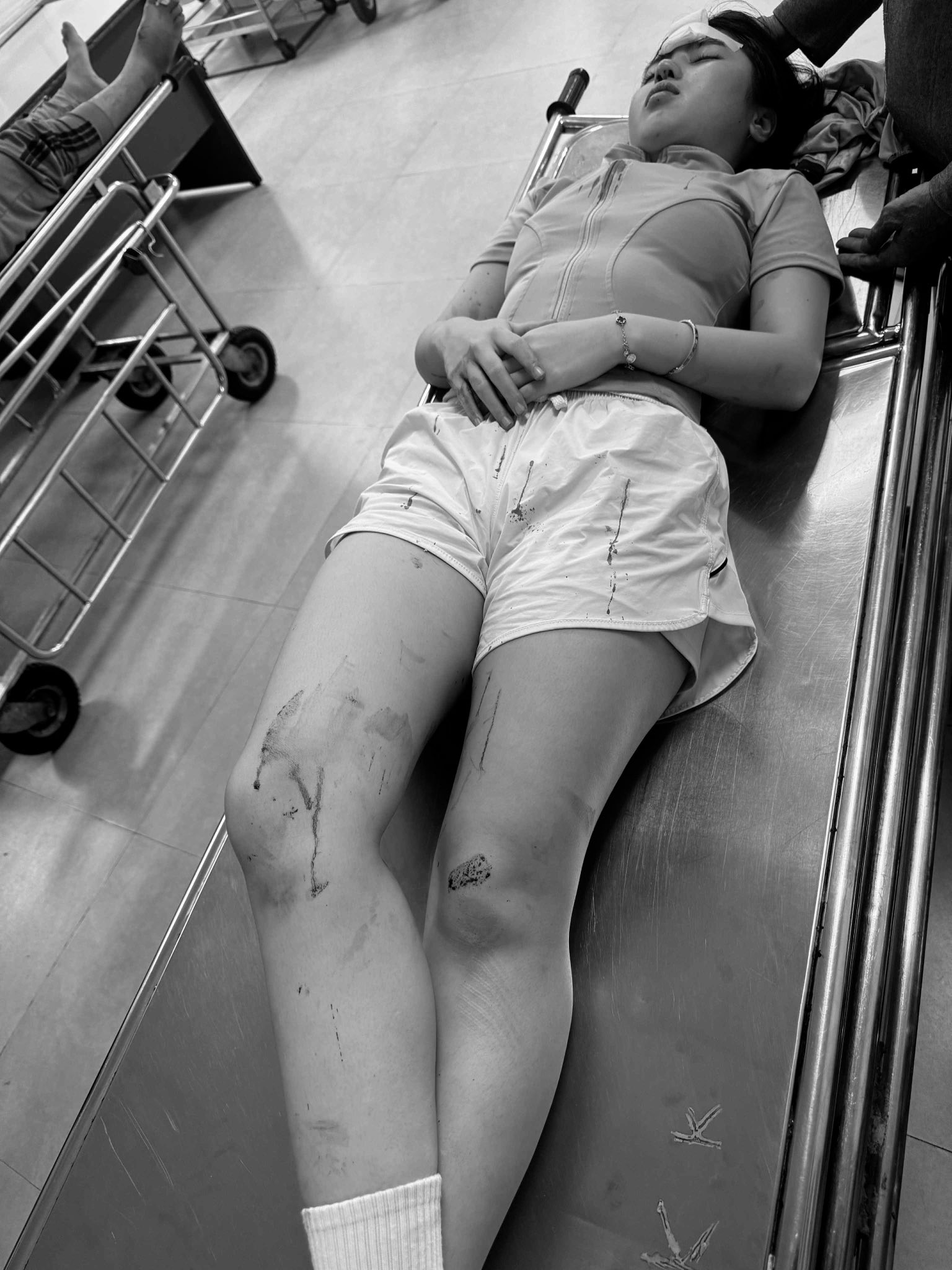 Xôn xao vụ cô gái bị ném vợt vào mặt trên sân pickleball, phải nhập viện cấp cứu- Ảnh 2.