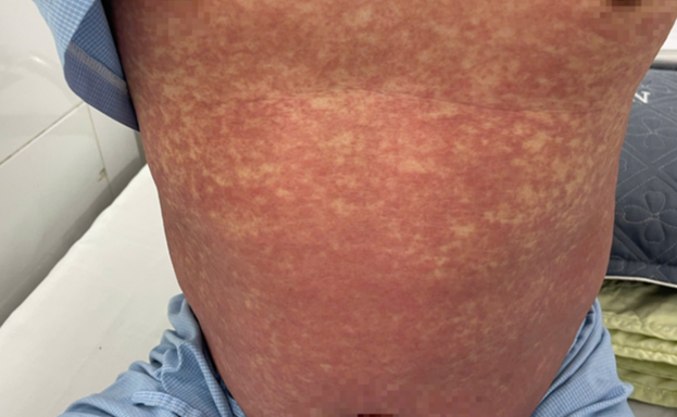 Thuốc trị đau khớp “thần tốc” chứa chất cấm- Ảnh 1.