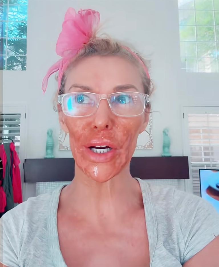 Nữ diễn viên mặt bị "ăn mòn" từng mảng, biến dạng nghiêm trọng vì lí do gì?- Ảnh 5.