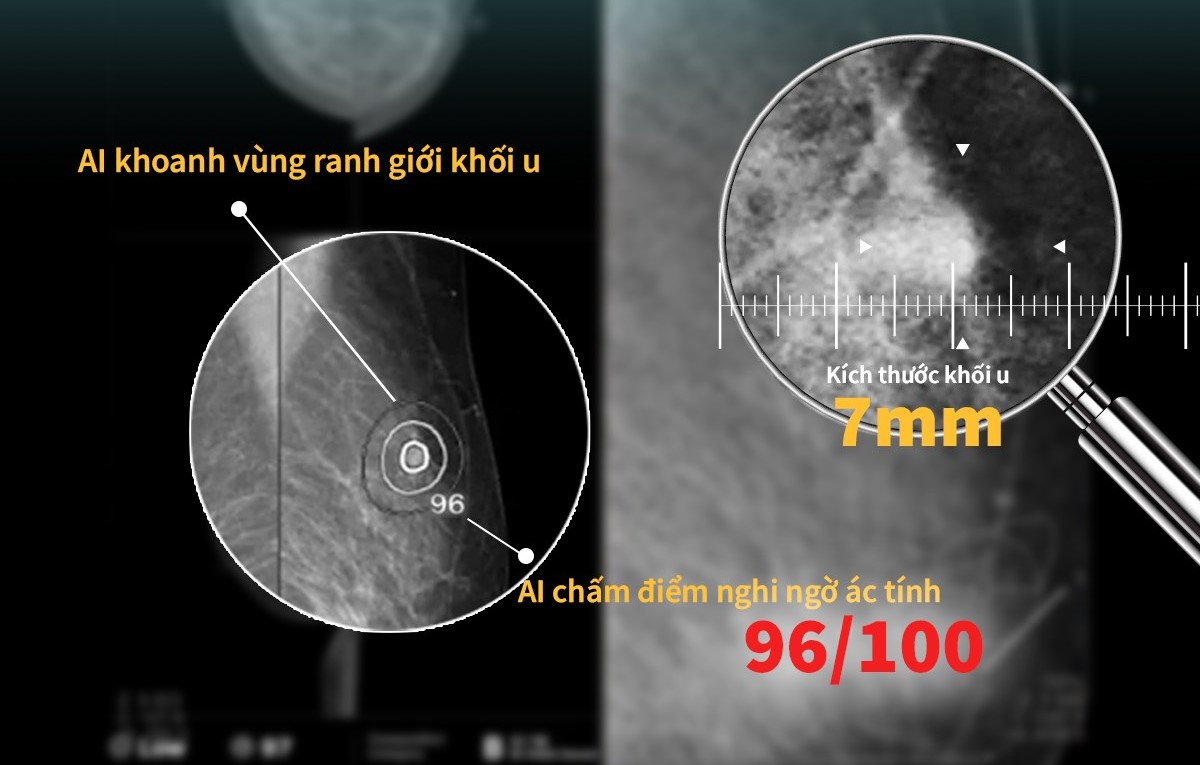 3 thứ trên cơ thể mà tế bào ung thư “ĐẶC BIỆT YÊU THÍCH”, khám định kỳ vẫn dễ để lọt khối u- Ảnh 3.