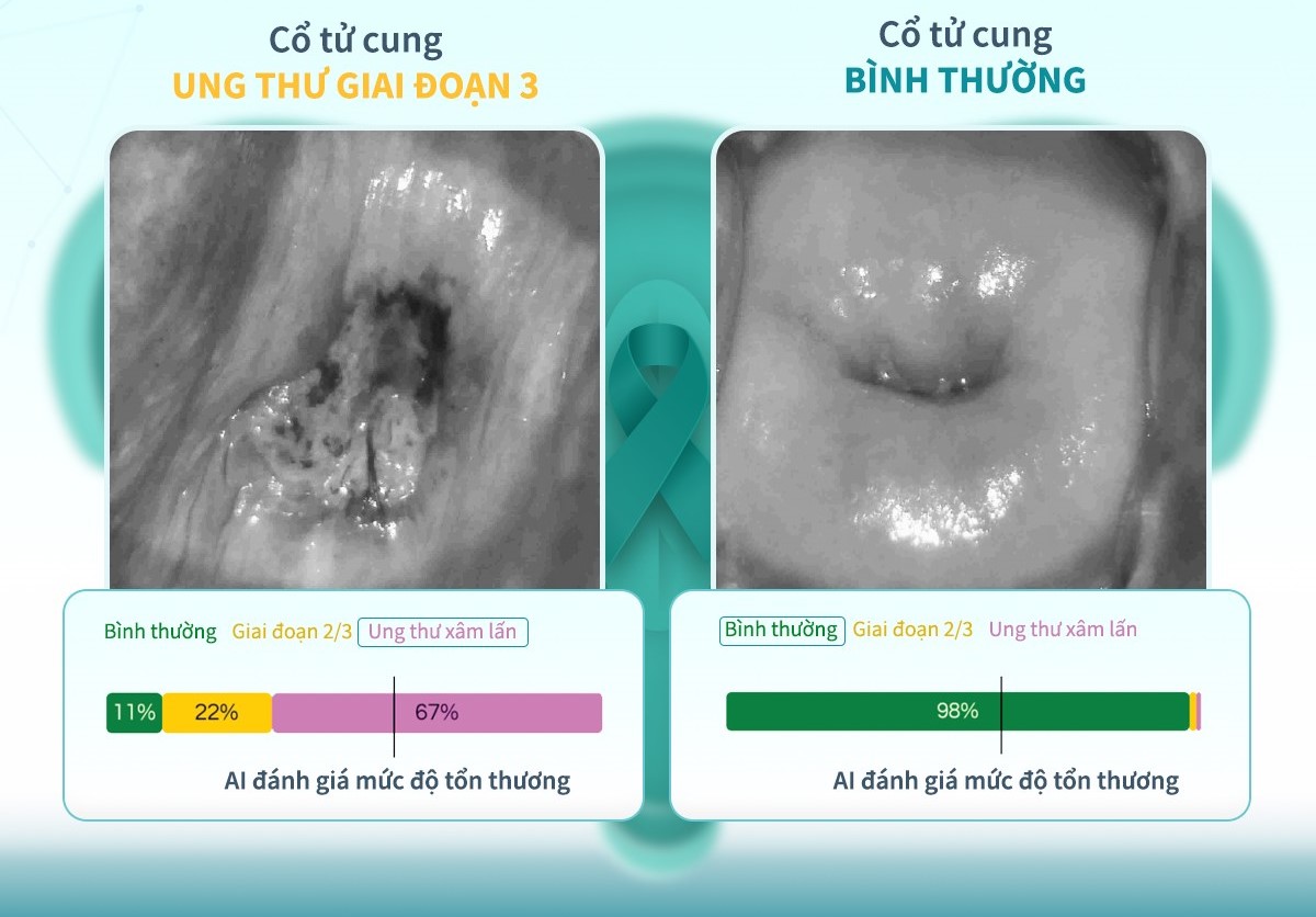 3 thứ trên cơ thể mà tế bào ung thư “ĐẶC BIỆT YÊU THÍCH”, khám định kỳ vẫn dễ để lọt khối u- Ảnh 6.