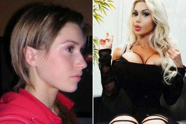 Chi gần 3 tỷ để trở thành "phiên bản hoàn hảo của công chúa Disney", người mẫu ngoài 30 tuổi phải dừng lại vì 1 lý do- Ảnh 2.