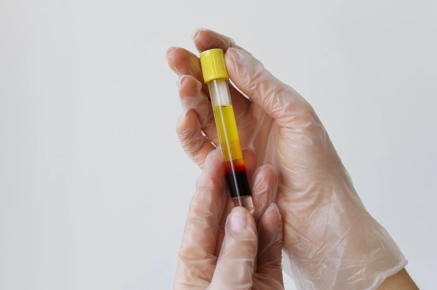 Người phụ nữ bị máu nhiễm mỡ, nguy cơ viêm tụy cấp sau sinh: BS nói nguyên nhân không chỉ là thay đổi nội tiết- Ảnh 1.