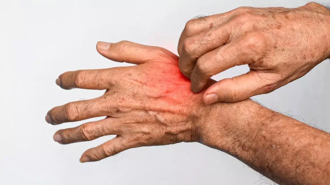 Sáng ngủ dậy thấy 5 dấu hiệu này, cẩn trọng vì có thể thận đang "lâm nguy": Có 1 cũng cần đi khám gấp- Ảnh 3.