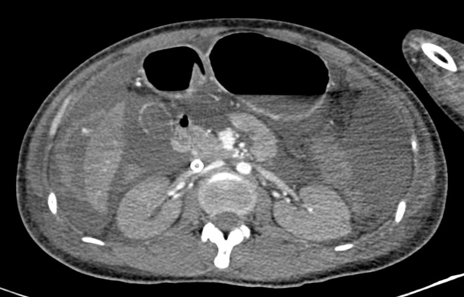 TP.HCM: Cô gái NGỪNG TIM liên tục ở tuổi 25, bác sĩ cũng phải thốt lên 'gặp một lần trong đời'”- Ảnh 1.