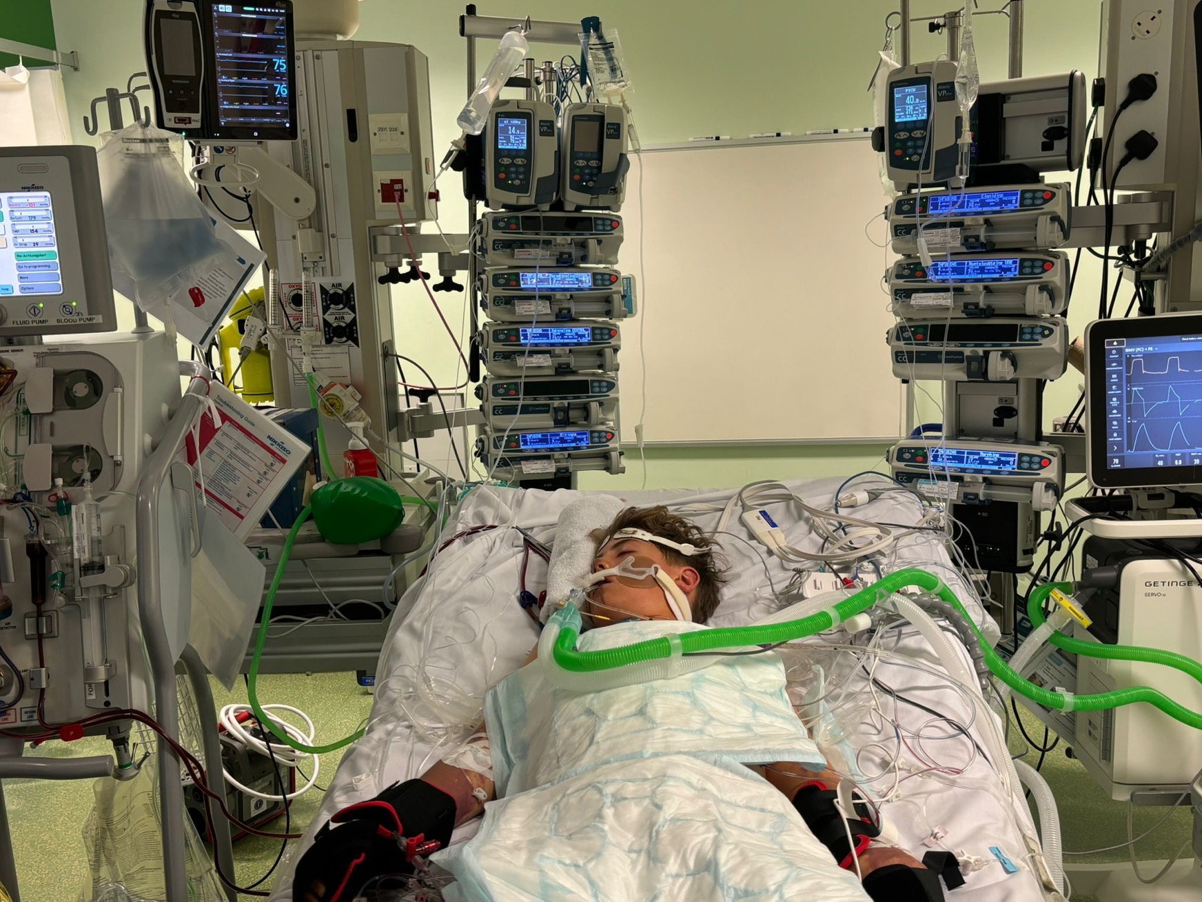 Bị chuột rút sau trại hè thể thao, cậu bé 13 tuổi phải cắt cụt 2 chân, cha mẹ lên tiếng cảnh báo- Ảnh 2.