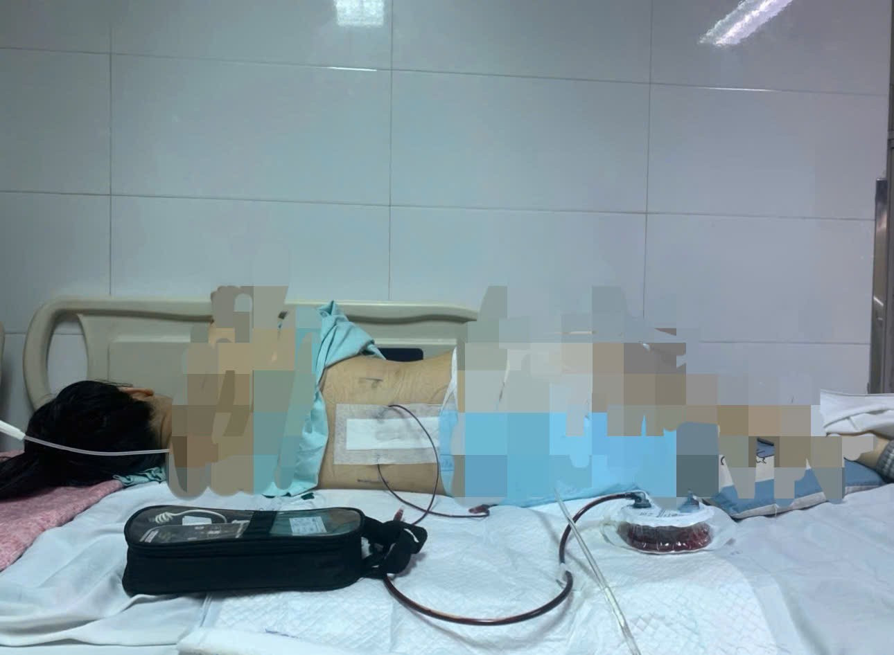 Khởi tố vụ cô gái mất 96% sức khỏe vì bị khung đỡ đèn tiệc cưới đổ sập, đè lên người- Ảnh 1.