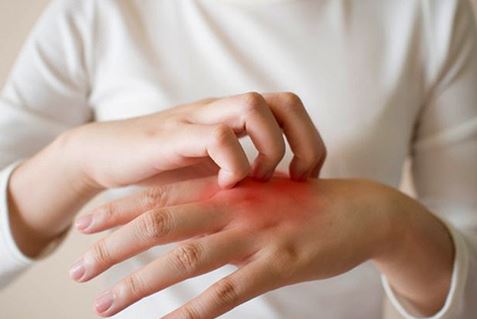 Đi khám vì bị ngứa khắp người, người phụ nữ sốc nặng trước thông báo của bác sĩ - Ảnh 1.