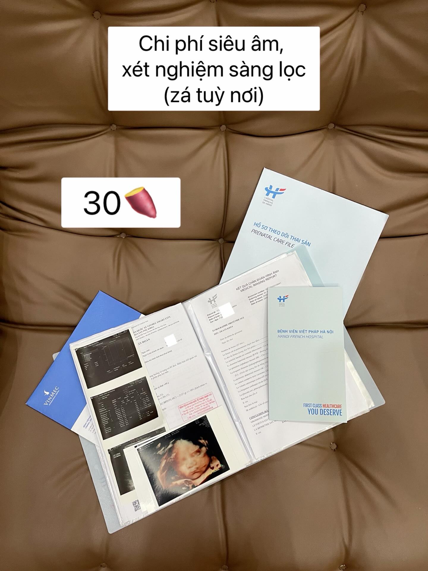 Viral Threads: Mẹ bỉm liệt kê chi phí sinh con gần 500 triệu, hội chưa đẻ tái mặt, choáng váng đến quay cuồng trời đất!- Ảnh 3.