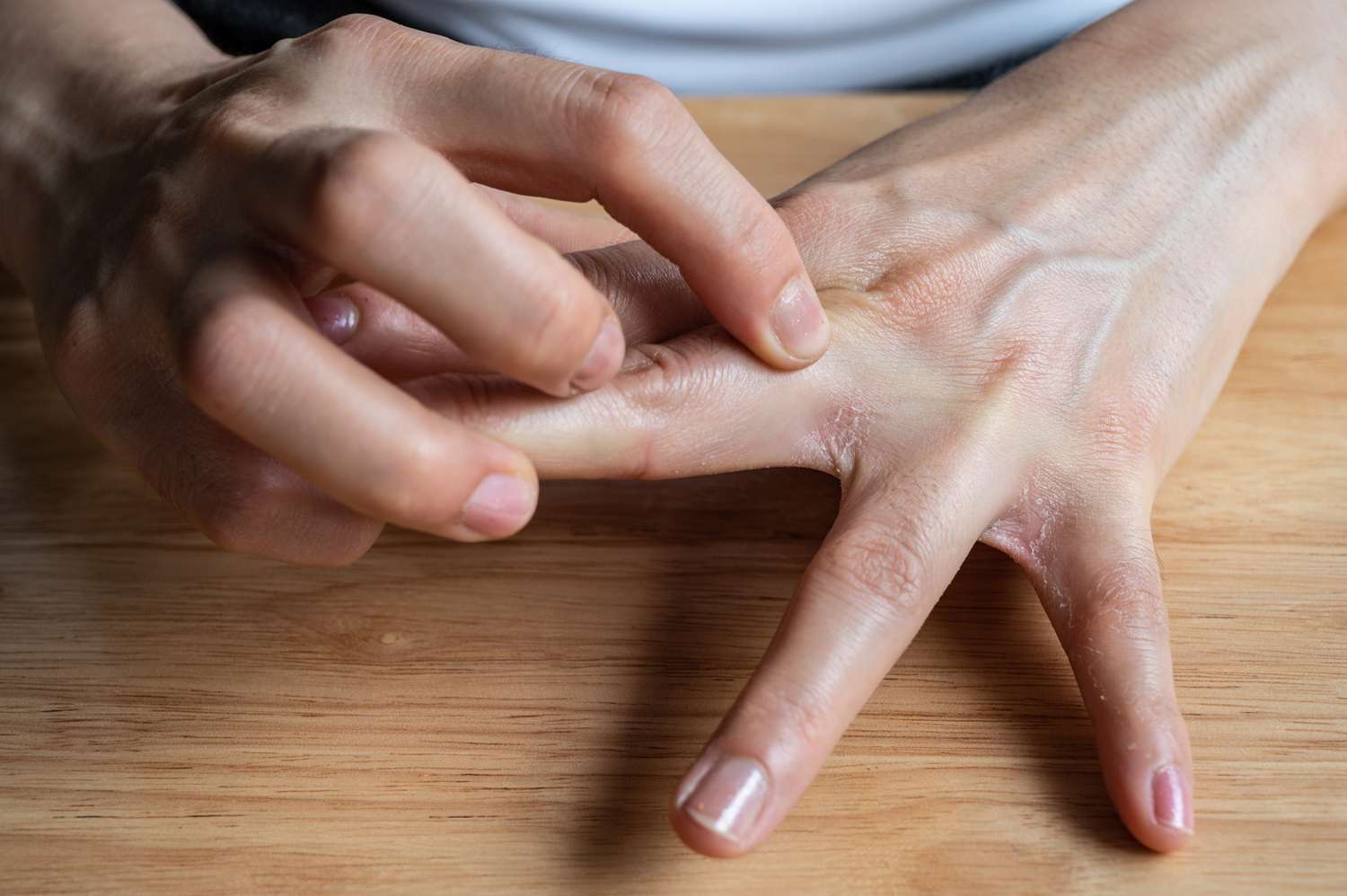 2 bộ phận trên cơ thể hay ngứa ngáy có thể là dấu hiệu ung thư gan, nhiều người dễ lầm tưởng là dị ứng- Ảnh 1.