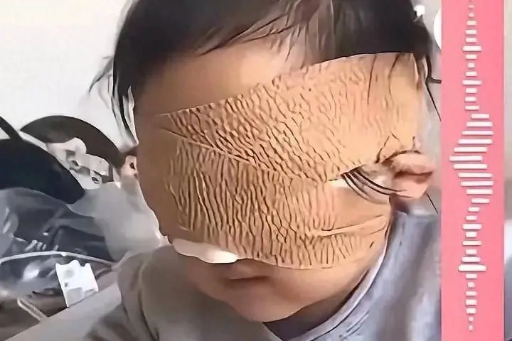 Bé gái 6 tuổi mất cả 2 mắt vì thứ nhiều bố mẹ vẫn cho con chơi mỗi ngày- Ảnh 1.