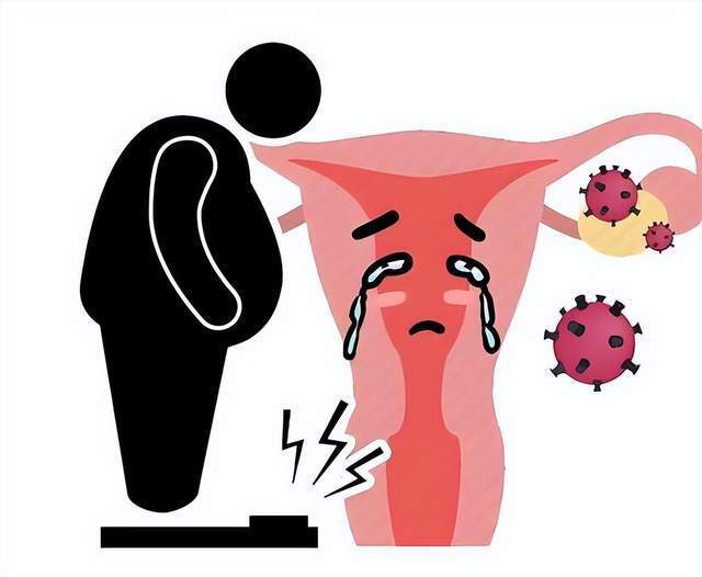 Căn bệnh ung thư chỉ phụ nữ mới mắc, là "kẻ giết người thầm lặng" nhưng giai đoạn đầu rất dễ nhầm với bệnh phụ khoa: Thấy 6 dấu hiệu phải đi khám ngay- Ảnh 4.