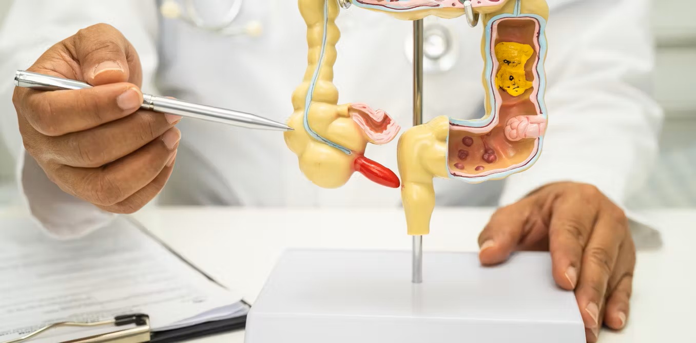 "Bệnh ung thư bị lãng quên” tăng bất thường ở người trẻ - Ảnh 1.