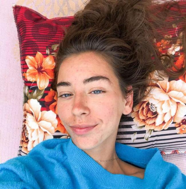 Cô gái 21 tuổi rụng gần hết tóc, móng tay bị giòn, da đầy mụn, cạn kiệt năng lượng chỉ vì theo đuổi kiểu ăn uống được cho là "thời thượng"- Ảnh 4.