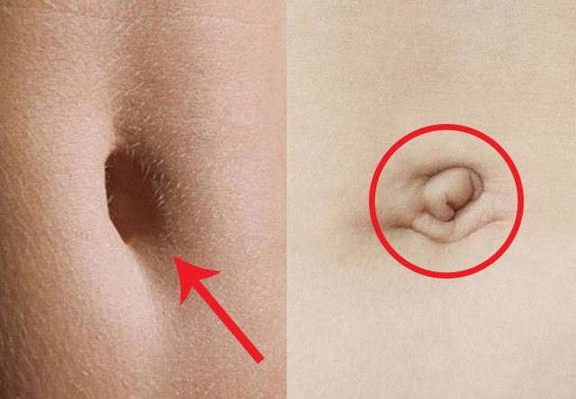 Rốn ẩn chứa bí mật "sinh lão bệnh tử": Người nào có 3 đặc điểm này ở rốn chứng tỏ có tuổi thọ kéo dài, sức khỏe viên mãn- Ảnh 2.