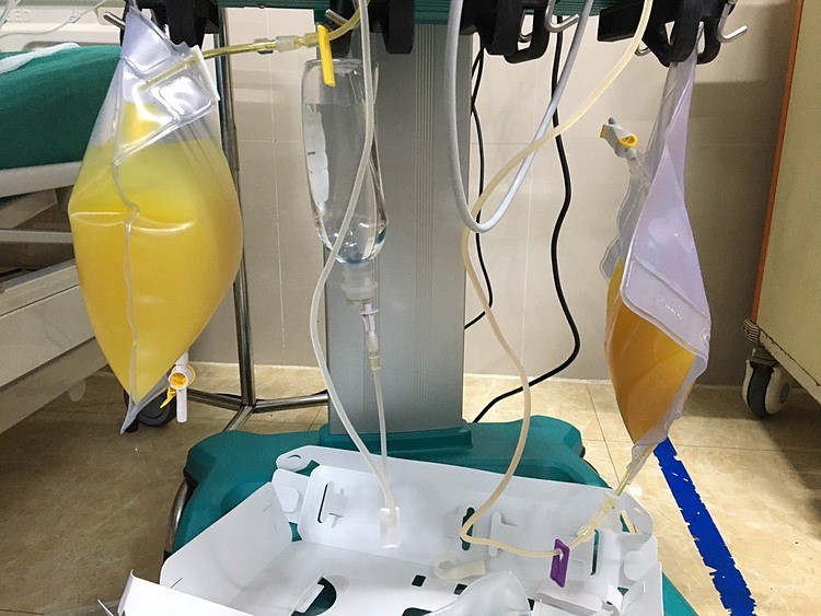 Hút ra gần 2 lít "dầu" từ trong máu người phụ nữ "thập tử nhất sinh" vì ăn thịt lợn kiểu này - Ảnh 1.