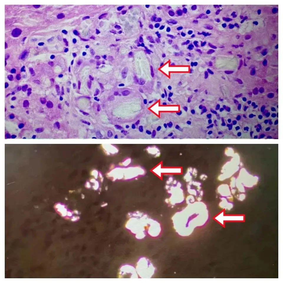 Người đàn ông suy thận vì ăn rau này hàng ngày- Ảnh 2.