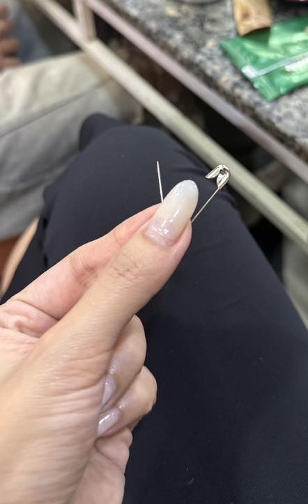 Đi ăn ốc, cô gái nuốt cả chiếc kim băng đang mở vào bụng, phải mổ cấp cứu 6 tiếng, tốn 70 triệu- Ảnh 5. Đi ăn ốc, cô gái nuốt cả chiếc kim băng đang mở vào bụng, phải mổ cấp cứu 6 tiếng, tốn 70 triệu- Ảnh 5.