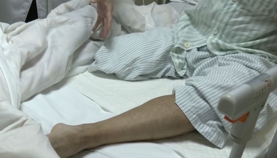 Người đàn ông bất ngờ phải cắt cụt bắp chân: Bác sĩ nói do chủ quan với 1 dấu hiệu ở chân- Ảnh 1. Người đàn ông bất ngờ phải cắt cụt bắp chân: Bác sĩ nói do chủ quan với 1 dấu hiệu ở chân- Ảnh 1.