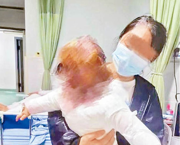 Bé trai 1 tuổi bỏng 40% cơ thể vì vật dụng nhà nào cũng có này phát nổ- Ảnh 1.