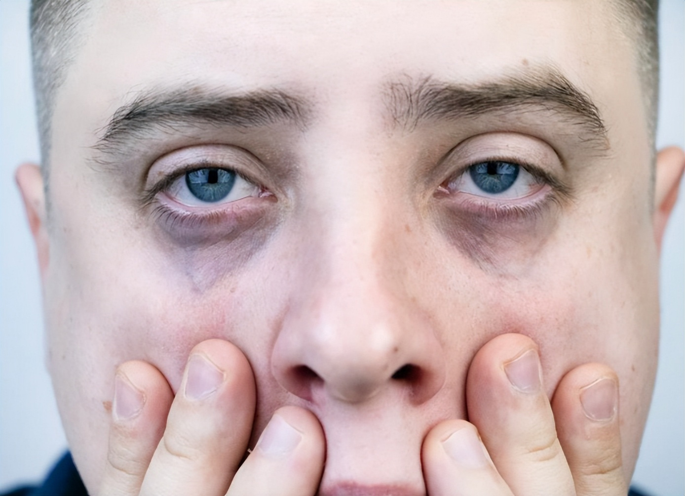 4 đặc điểm trên khuôn mặt báo hiệu bệnh tật hoặc ung thư: Đừng nhầm lẫn chúng với "những nét may mắn"! - Ảnh 1.