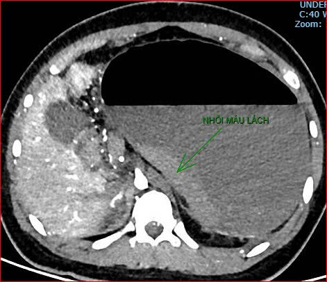 Bệnh viện Việt Nam - Cu Ba Đồng Hới thông tin ca bệnh hiếm gặp gây tử vong - Ảnh 4.