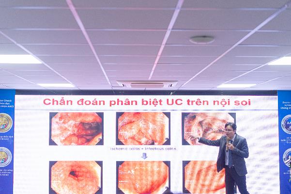Viêm loét đại tràng trị hoài không khỏi, vì sao cần nội soi và sinh thiết chuẩn? - Ảnh 1. Viêm loét đại tràng trị hoài không khỏi, vì sao cần nội soi và sinh thiết chuẩn? - Ảnh 1.
