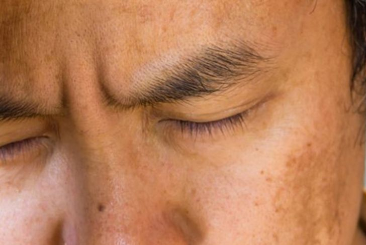 Đàn ông có chức năng thận kém, "chuyện ấy" khiêm tốn thường xuất hiện 4 dấu hiệu trên khuôn mặt - Ảnh 2. Đàn ông có chức năng thận kém, "chuyện ấy" khiêm tốn thường xuất hiện 4 dấu hiệu trên khuôn mặt - Ảnh 2.