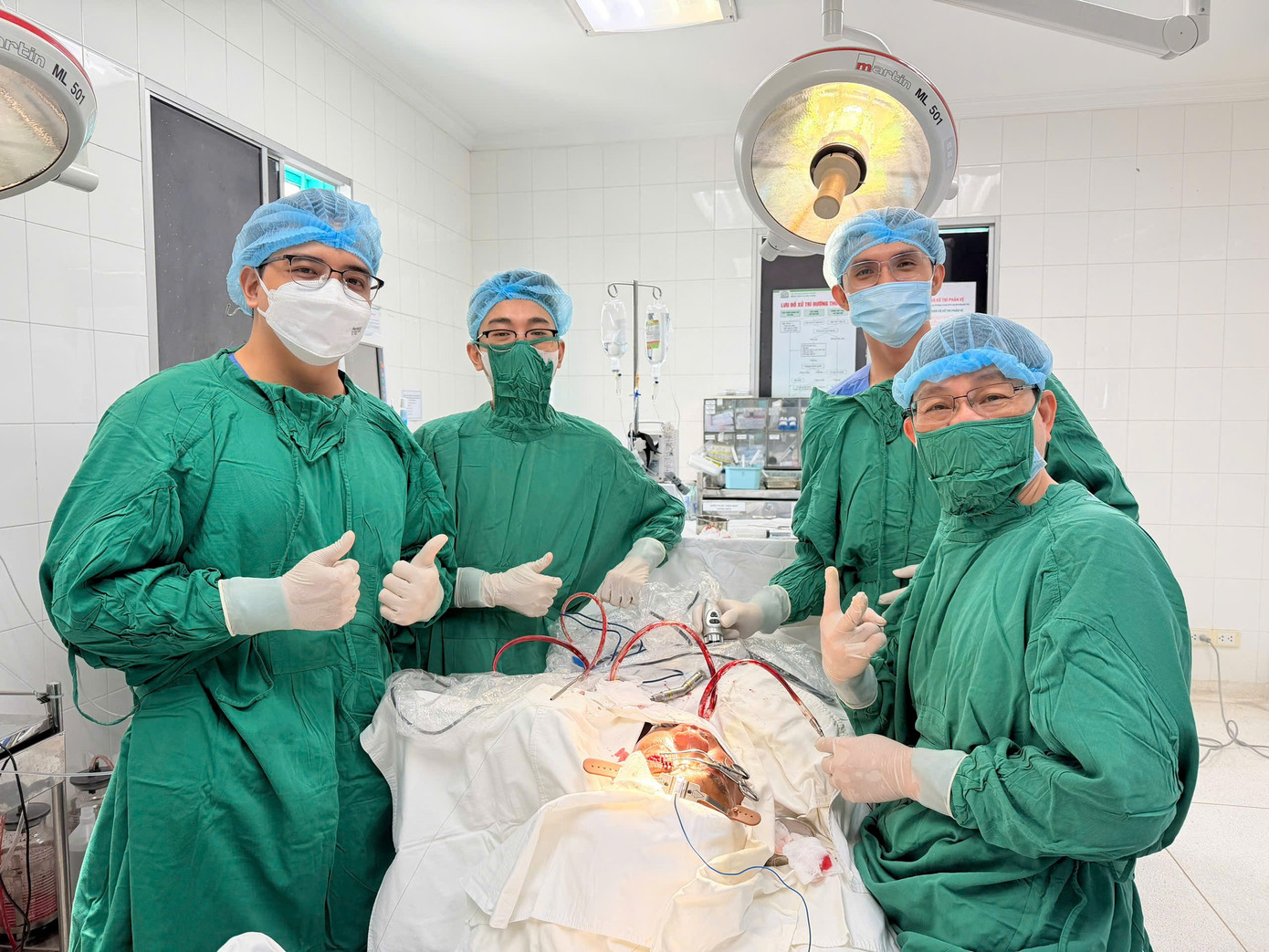 Khối u hiếm gặp tại xoang trán gây nguy hiểm đến thị lực người bệnh - Ảnh 2. Khối u hiếm gặp tại xoang trán gây nguy hiểm đến thị lực người bệnh - Ảnh 2.