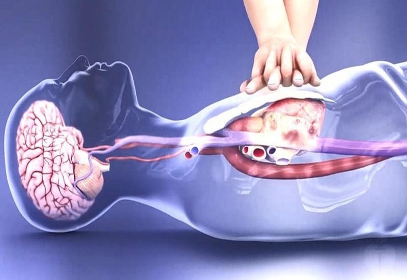 Cấp cứu ngừng tim: Cảnh báo khung giờ tử thần và bí quyết sống sót - Ảnh 2.