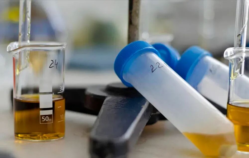 Dấu hiệu suy giảm chức năng thận bạn không nên bỏ qua để bảo vệ sức khỏe - Ảnh 3.