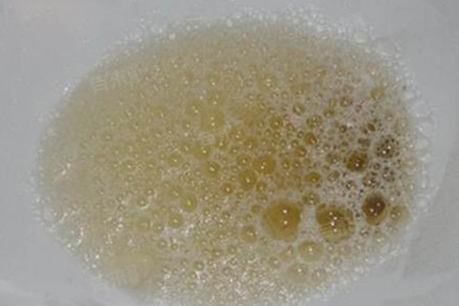 Dấu hiệu suy giảm chức năng thận bạn không nên bỏ qua để bảo vệ sức khỏe - Ảnh 2.