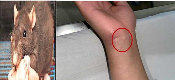 Bệnh viện Trung ương Quân đội 108 cảnh báo về sốt do chuột cắn , bệnh nguy hiểm cần lưu ý - Ảnh 2.