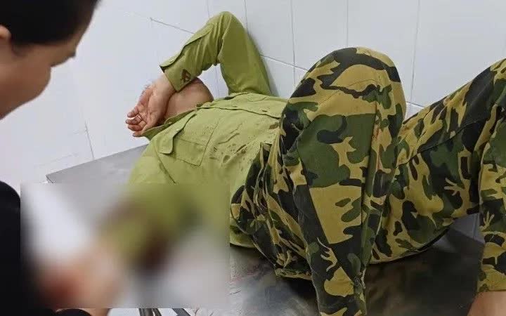 Đồng Nai: Làm rõ vụ đối tượng chém bị thương nhân viên bảo vệ rừng khi tuần tra đêm - Ảnh 1.