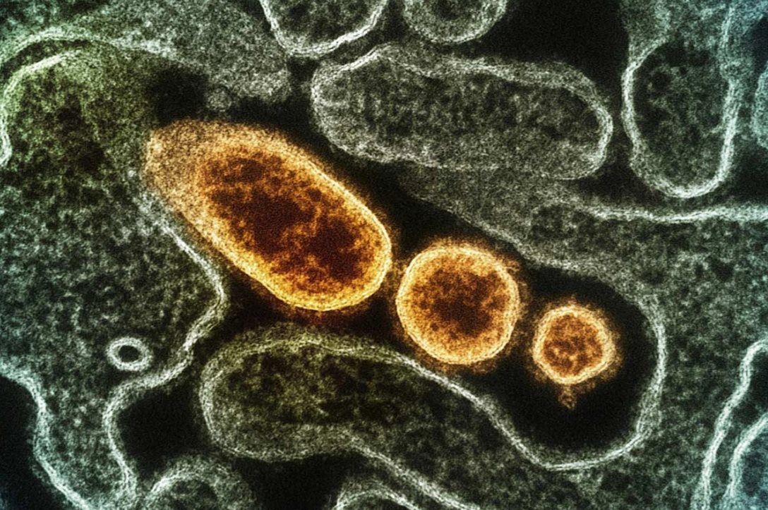 Virus Nipah trong thực phẩm hữu cơ: Nguy cơ và cách phòng tránh cho người tiêu dùng - Ảnh 3. Virus Nipah trong thực phẩm hữu cơ: Nguy cơ và cách phòng tránh cho người tiêu dùng - Ảnh 3.