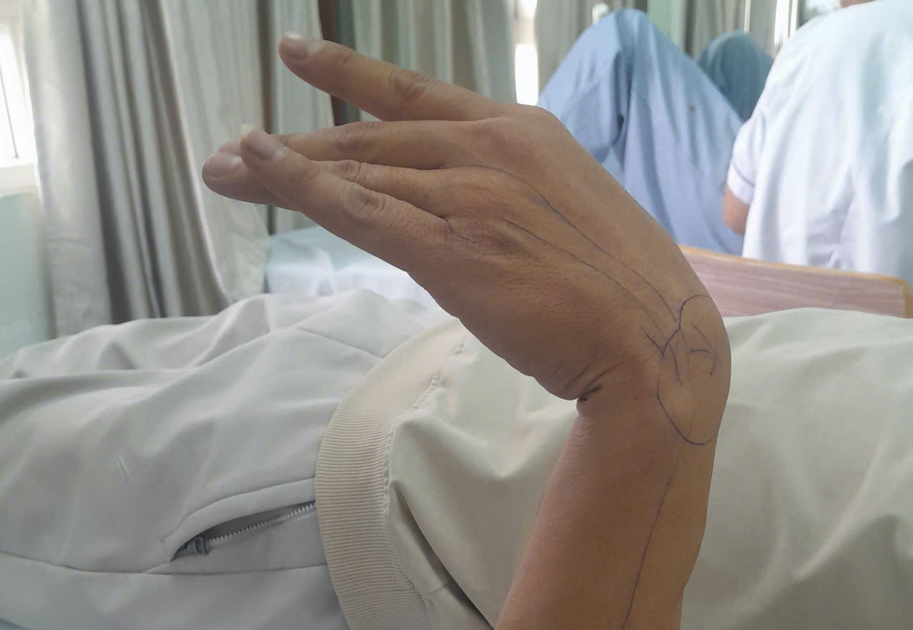 Ai vẫn ngủ trưa tư thế này tại văn phòng nên bỏ ngay - Ảnh 1.